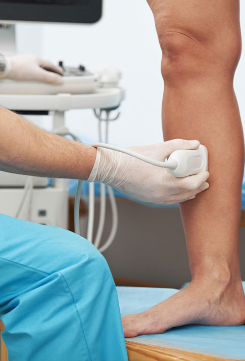 Ecografia vascular com doppler de membros