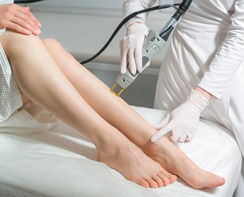 img-laser-tratamentos-para-varizes-cardioadvance